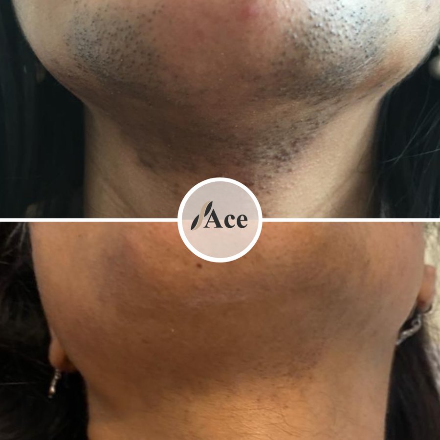 Ace Aesthetics - Ace Aesthetics